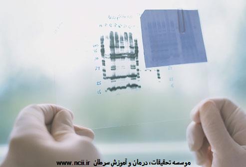 ژن‌های سرطان پستان