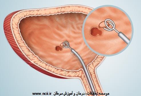 تشخیص: آزمایش
